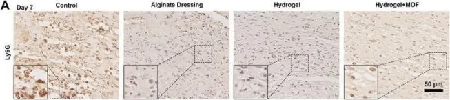 Fig.7.A showing Immunohistochemistry from the publication: Thermosensitive Hydrogel Integrated with Bimetallic Nano-Enzymes for Modulating the Microenvironment in Diabetic Wound Beds.