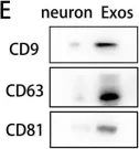 Fig.2.E showing Western Blotting from the publication: Pericyte-derived exosomal miR-210 improves mitochondrial function and inhibits lipid peroxidation in vascular endothelial cells after traumatic spinal cord injury by activating JAK1/STAT3 signaling pathway.