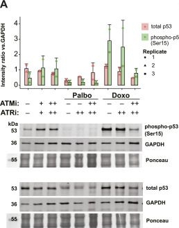 Fig.6.A showing Western Blotting in a Homo sapiens (Human) sample from the publication: CDK4/6 inhibition induces a senescence-associated secretory phenotype via delayed NF-κB activation.