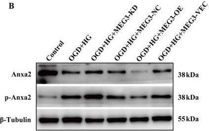 Fig.6.B showing Western Blotting from the publication: LncRNA-MEG3 Mediated Diabetic Cerebral Ischemia-Reperfusion Injury-Induced Apoptosis via Modulating Interaction Between Annexin A2 and Akt in Mitochondria.