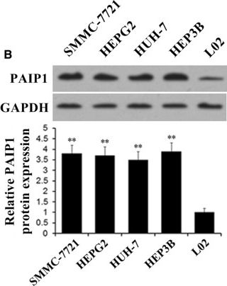 Fig.1.B showing Western Blotting from the publication: PAIP1 is a novel oncogene in human hepatocellular carcinoma.
