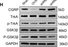 Fig.4.H showing Western Blotting from the publication: Inhibition of inflammatory osteoclasts accelerates callus remodeling in osteoporotic fractures by enhancing CGRP+TrkA+ signaling.
