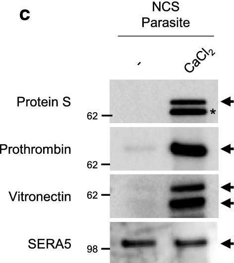 Fig.3.C showing Western Blotting from the publication: The malaria parasite Plasmodium falciparum in red blood cells selectively takes up serum proteins that affect host pathogenicity.
