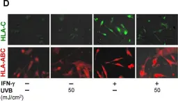 Fig.1.D showing Immunocytochemistry-immunofluorescence from the publication: Down-Regulation of HLA-C Expression on Melanocytes May Contribute to the Therapeutic Efficacy of UVB Phototherapy in Psoriasis.