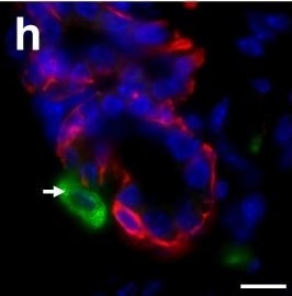 Macrophages orchestrate breast cancer early dissemination and metastasis.