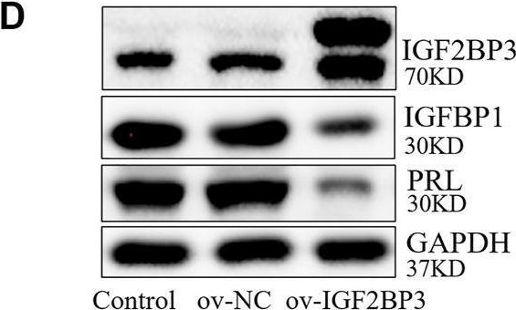 Fig.2.D showing Western Blotting from the publication: The Mechanism of Insulin-Like Growth Factor II mRNA-Binging Protein 3 Induce Decidualization and Maternal-Fetal Interface Cross Talk by TGF-β1 in Recurrent Spontaneous Abortion.