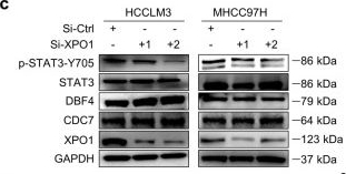 Fig.5.C showing Western Blotting from the publication: DBF4 Dependent Kinase Inhibition Suppresses Hepatocellular Carcinoma Progression and Potentiates Anti-Programmed Cell Death-1 Therapy.