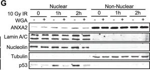 Fig.1.G showing Western Blotting in a Homo sapiens (Human) sample from the publication: Genotoxic agents promote the nuclear accumulation of annexin A2: role of annexin A2 in mitigating DNA damage.