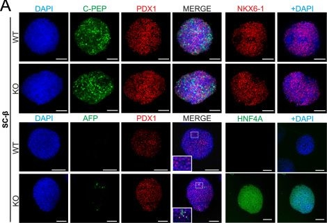 Fig.4.A showing Immunocytochemistry-immunofluorescence in a Homo sapiens (Human) sample from the publication: Oxidative stress and GPX2 control pancreatic vs. non-pancreatic cell fate in human endoderm.