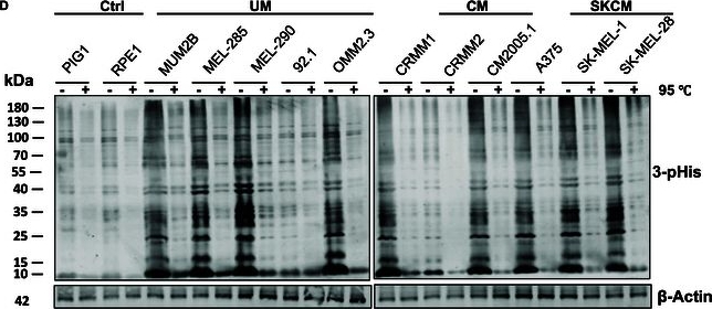 Fig.1.D showing Western Blotting from the publication: LHPP Attenuates Lipid Dysfunction of Uveal Melanoma by Relieving the Histidine Phosphorylation of ACO2.