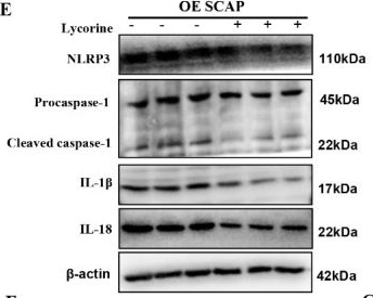 Fig.4.E showing Western Blotting from the publication: Sterol-resistant SCAP Overexpression in Vascular Smooth Muscle Cells Accelerates Atherosclerosis by Increasing Local Vascular Inflammation through Activation of the NLRP3 Inflammasome in Mice.