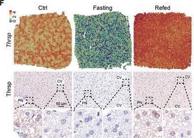 Fig.2.F showing Immunohistochemistry from the publication: Spatial Transcriptomic Study Reveals Heterogeneous Metabolic Adaptation and a Role of Pericentral PPARα/CAR/Ces2a Axis During Fasting in Mouse Liver.