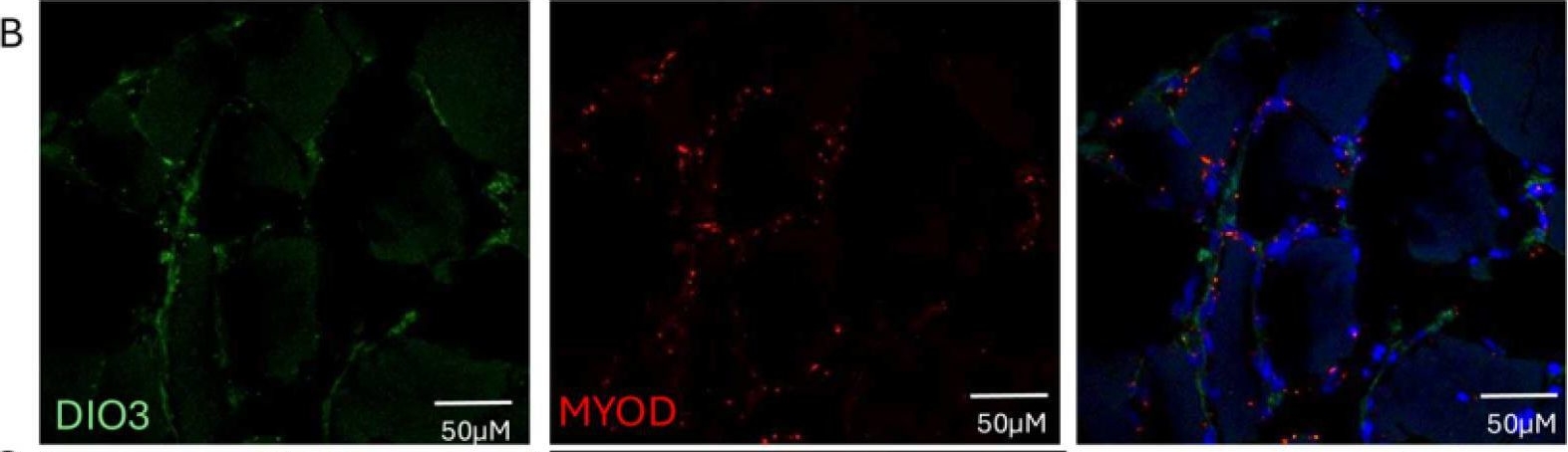 Dio3 DIO3 antibodies - Antibody search engine - CiteAb