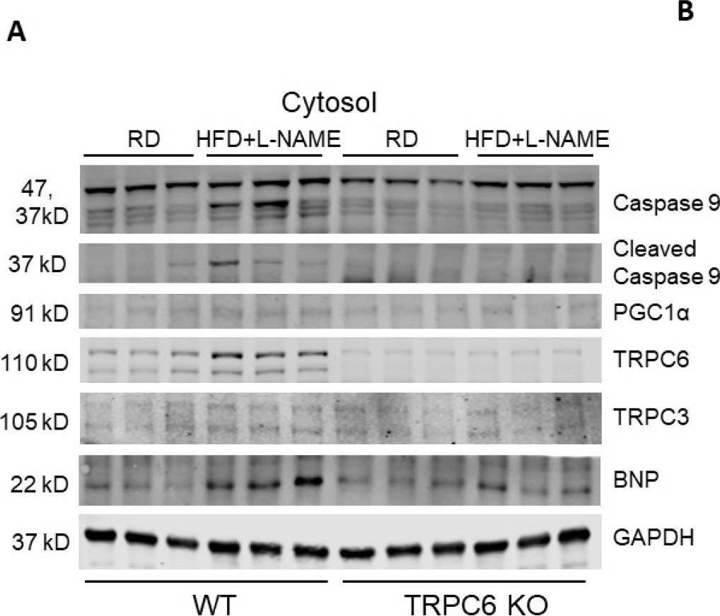 Fig.6.A showing Western Blotting from the publication: TRPC6 Deficiency Attenuates Mitochondrial and Cardiac Dysfunction in Heart Failure with Preserved Ejection Fraction Induced by High-Fat Diet Plus L-NAME.