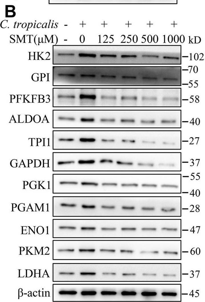 Fig.4.B showing Western Blotting from the publication: Gut fungi enhances immunosuppressive function of myeloid-derived suppressor cells by activating PKM2-dependent glycolysis to promote colorectal tumorigenesis.