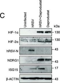Fig.4.C showing Western Blotting in a Homo sapiens (Human) sample from the publication: Hypoxia inducible factors regulate pneumovirus replication by enhancing innate immune sensing.