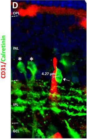 Fig.5.D showing Immunohistochemistry in a Mus musculus (House mouse) sample from the publication: In Utero Alcohol Exposure Impairs Retinal Angiogenesis and the Microvessel-Associated Positioning of Calretinin Interneurons.