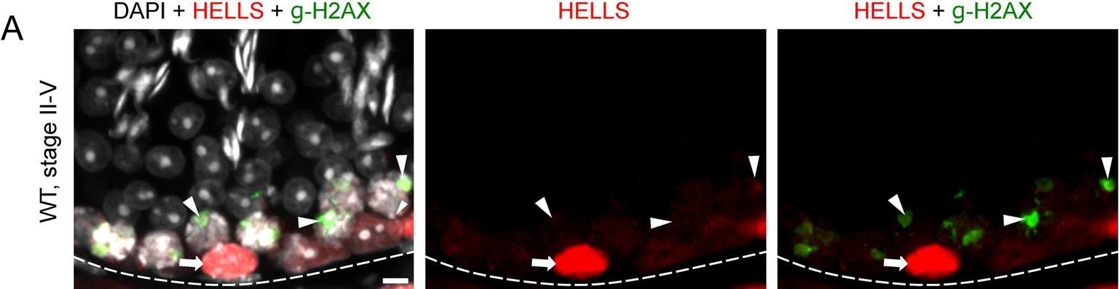 Fig.1.A showing Immunohistochemistry-immunofluorescence in a Mus musculus (House mouse) sample from the publication: Chromatin remodelers HELLS, WDHD1 and BAZ1A are dynamically expressed during mouse spermatogenesis.