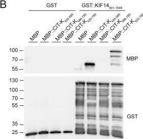 Fig.6.B showing Western Blotting in an Oryctolagus cuniculus (Rabbit) sample from the publication: Regulation of Citron kinase by CDK1 and Aurora B regulates midbody formation and stability.