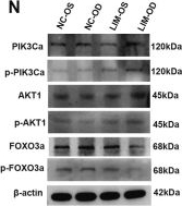 Fig.1.N showing Western Blotting from the publication: Quercetin improves retinal glycolysis to slow myopia progression through orchestrating the AKT/FOXO/HK2 axis.