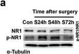 Fig.7.A showing Western Blotting in a Mus musculus (House mouse) sample from the publication: Activation of the Lateral Habenula-Ventral Tegmental Area Neural Circuit Contributes to Postoperative Cognitive Dysfunction in Mice.