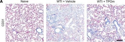 CD31 Antibody (PECAM-1) (D8V9E) XP® Rabbit mAb | Cell