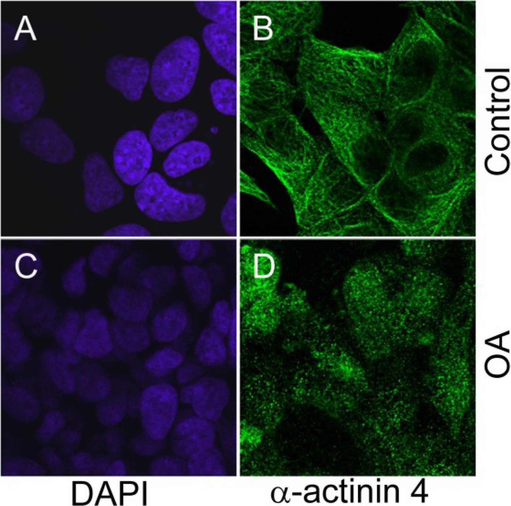Fig.5.A showing Immunocytochemistry-immunofluorescence in a Homo sapiens (Human) sample from the publication: Identification of dynamic changes in proteins associated with the cellular cytoskeleton after exposure to okadaic acid.