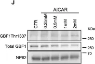Fig.7.J showing Western Blotting from the publication: A GBF1-Dependent Mechanism for Environmentally Responsive Regulation of ER-Golgi Transport.