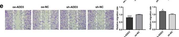Fig.6.E showing Immunohistochemistry from the publication: Knockdown of long noncoding RNA SAN rejuvenates aged adipose-derived stem cells via miR-143-3p/ADD3 axis.