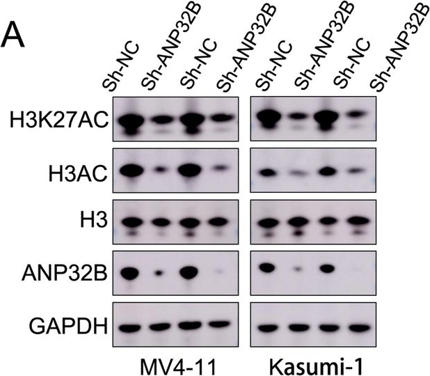 Fig.7.A showing Western Blotting from the publication: Super enhancer related gene ANP32B promotes the proliferation of acute myeloid leukemia by enhancing MYC through histone acetylation.