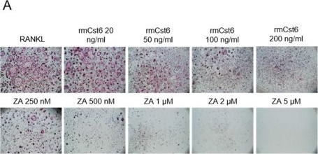 Fig.4.A showing Immunohistochemistry from the publication: Cystatin M/E Ameliorates Multiple Myeloma-Induced Hyper Osteolytic Bone Resorption.