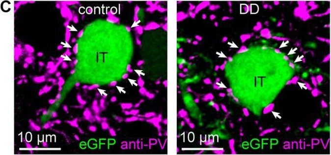 Fig.5.C showing Immunohistochemistry-immunofluorescence from the publication: Loss of Midbrain Dopamine Neurons Does Not Alter GABAergic Inhibition Mediated by Parvalbumin-Expressing Interneurons in Mouse Primary Motor Cortex.