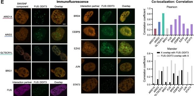Fig.5.E showing Immunocytochemistry-immunofluorescence in a Homo sapiens (Human) sample from the publication: FET fusion oncoproteins enrich SWI/SNF complex subtypes and interaction partners.