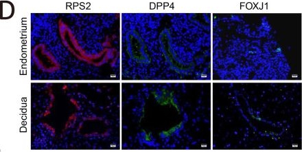 Fig.4.D showing Immunohistochemistry-immunofluorescence from the publication: An IGF1-expressing endometrial stromal cell population is associated with human decidualization.