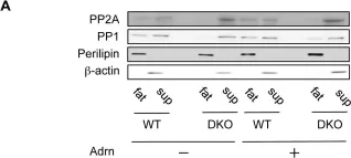 Fig.4.A showing Western Blotting from the publication: Phospholipase C-related catalytically inactive protein (PRIP) regulates lipolysis in adipose tissue by modulating the phosphorylation of hormone-sensitive lipase.