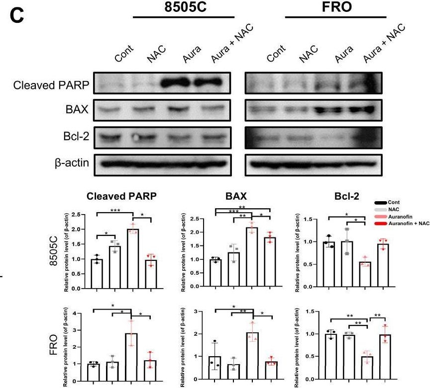 Fig.3.C showing Western Blotting in a Homo sapiens (Human) sample from the publication: Auranofin as a Novel Anticancer Drug for Anaplastic Thyroid Cancer.