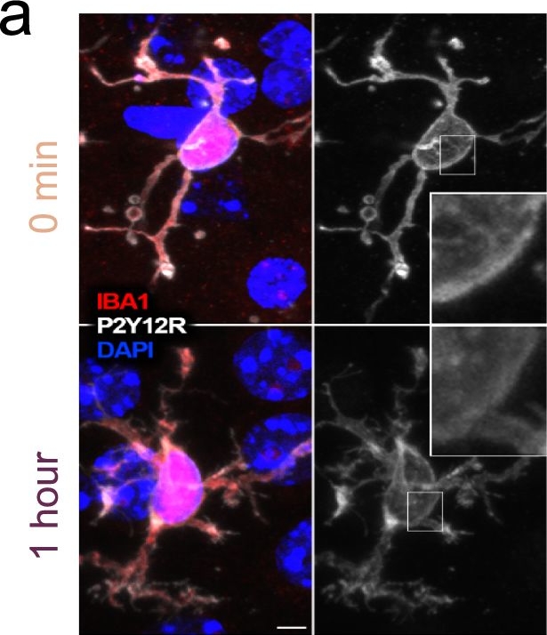 Fig.6.A showing Immunocytochemistry-immunofluorescence from the publication: Microglia contribute to neuronal synchrony despite endogenous ATP-related phenotypic transformation in acute mouse brain slices.