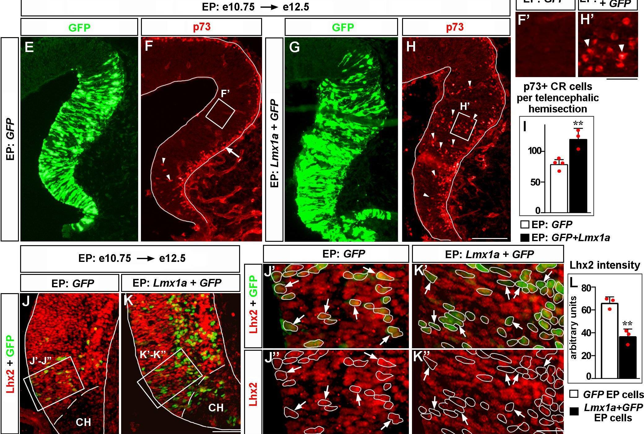 Fig.6.E showing Immunohistochemistry-immunofluorescence in a Mus musculus (House mouse) sample from the publication: Lmx1a is a master regulator of the cortical hem.