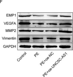 Fig.6.F showing Western Blotting in a Homo sapiens (Human) sample from the publication: LncRNA UNC5C-AS1 inhibits angiogenesis and induces endothelial apoptosis via the miR-148a-3p/EMP1 axis in preeclampsia.