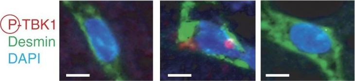 Fig.6.E showing Immunocytochemistry-immunofluorescence in a Mus musculus (House mouse) sample from the publication: Downregulation of cytoplasmic DNases is implicated in cytoplasmic DNA accumulation and SASP in senescent cells.