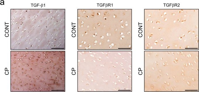 Fig.6.A showing Immunohistochemistry from the publication: Does Chronic Pancreatitis in Growing Pigs Lead to Articular Cartilage Degradation and Alterations in Subchondral Bone?