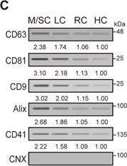 Fig.2.C showing Western Blotting from the publication: Extracellular Vesicle-Delivered tRF-His-GTG-1 Reprograms Neutrophil Lipophagy and Triggers Inflammation in COVID-19.