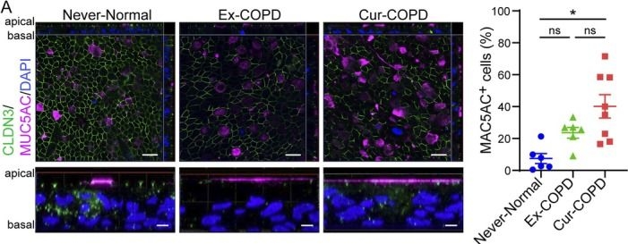 Fig.3.A showing Immunohistochemistry-immunofluorescence in a Homo sapiens (Human) sample from the publication: Epigenetic Dysregulation of the NKX2-1/SPDEF Axis Drives Persistent Goblet Cell Differentiation and Epithelial Barrier Dysfunction in Chronic Obstructive Pulmonary Disease.