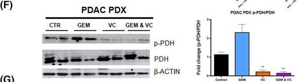 Fig.5.F showing Western Blotting in a Homo sapiens (Human) sample from the publication: Vitamin-C-dependent downregulation of the citrate metabolism pathway potentiates pancreatic ductal adenocarcinoma growth arrest.