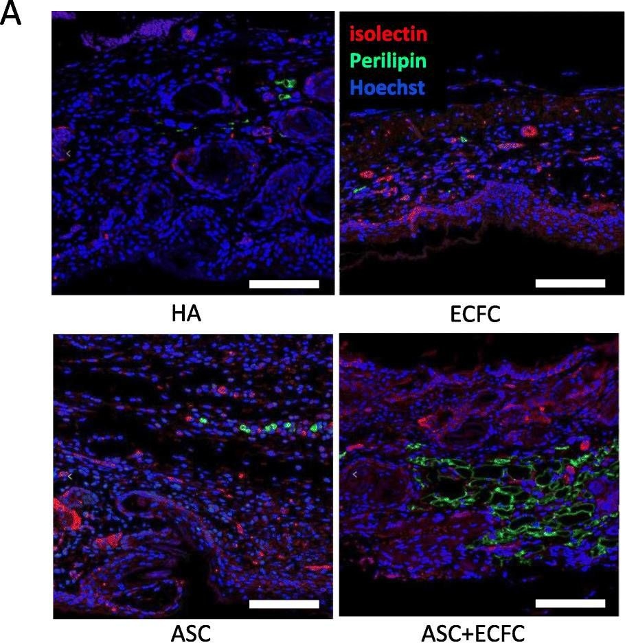 3D co-culture model of endothelial colony-forming cells (ECFCs) reverses late passage adipose-derived stem cell senescence for wound healing.