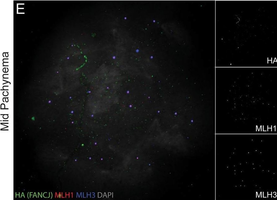 Fig.7.E showing Immunocytochemistry-immunofluorescence in a Mus musculus (House mouse) sample from the publication: The DNA helicase FANCJ (BRIP1) functions in double strand break repair processing, but not crossover formation during prophase I of meiosis in male mice.
