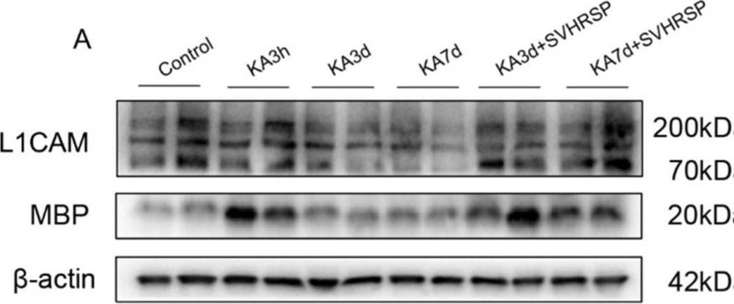 Fig.6.A showing Western Blotting in a Rattus norvegicus (Rat) sample from the publication: The Upregulation of L1CAM by SVHRSP Mitigates Neuron Damage, Spontaneous Seizures, and Cognitive Dysfunction in a Kainic Acid-Induced Rat Model of Epilepsy.