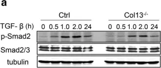 Fig.6.A showing Western Blotting from the publication: Membrane associated collagen XIII promotes cancer metastasis and enhances anoikis resistance.