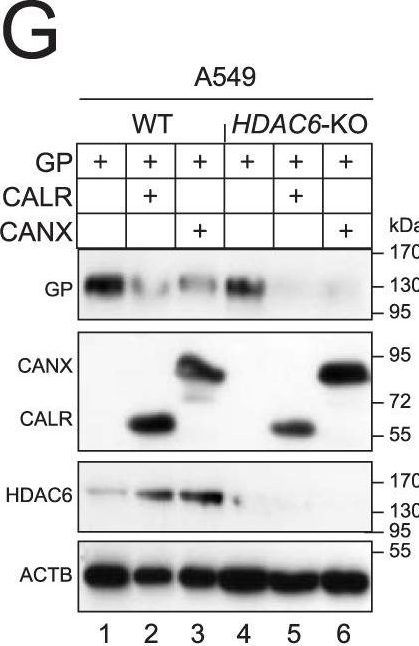 Fig.4.G showing Western Blotting in a Homo sapiens (Human) sample from the publication: RNF185 regulates proteostasis in Ebolavirus infection by crosstalk between the calnexin cycle, ERAD, and reticulophagy.