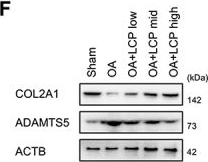 Fig.1.F showing Western Blotting from the publication: Lactucopicrin promotes the autophagic degradation of MAP2K4/MKK4 by mediating CCDC50 palmitoylation to alleviate osteoarthritis progression.